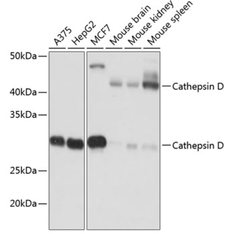 Western Blot - Anti-Cathepsin D Antibody [ARC0160] (A306359) - Antibodies.com