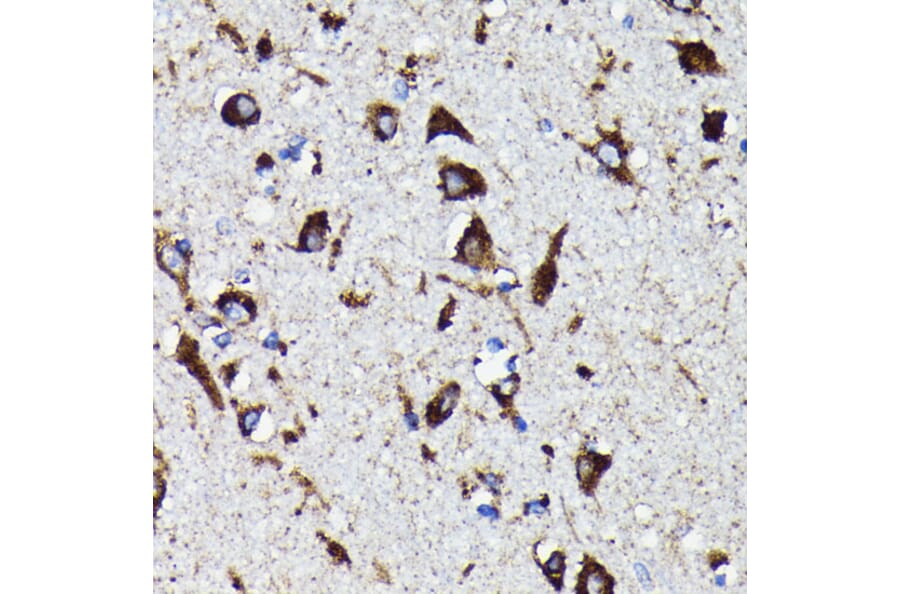 Immunohistochemistry - Anti-Cathepsin D Antibody [ARC0160] (A306359) - Antibodies.com