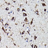 Immunohistochemistry - Anti-Cathepsin D Antibody [ARC0160] (A306359) - Antibodies.com