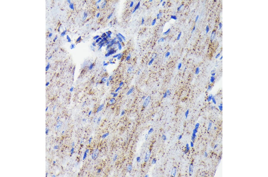 Immunohistochemistry - Anti-Cathepsin D Antibody [ARC0160] (A306359) - Antibodies.com