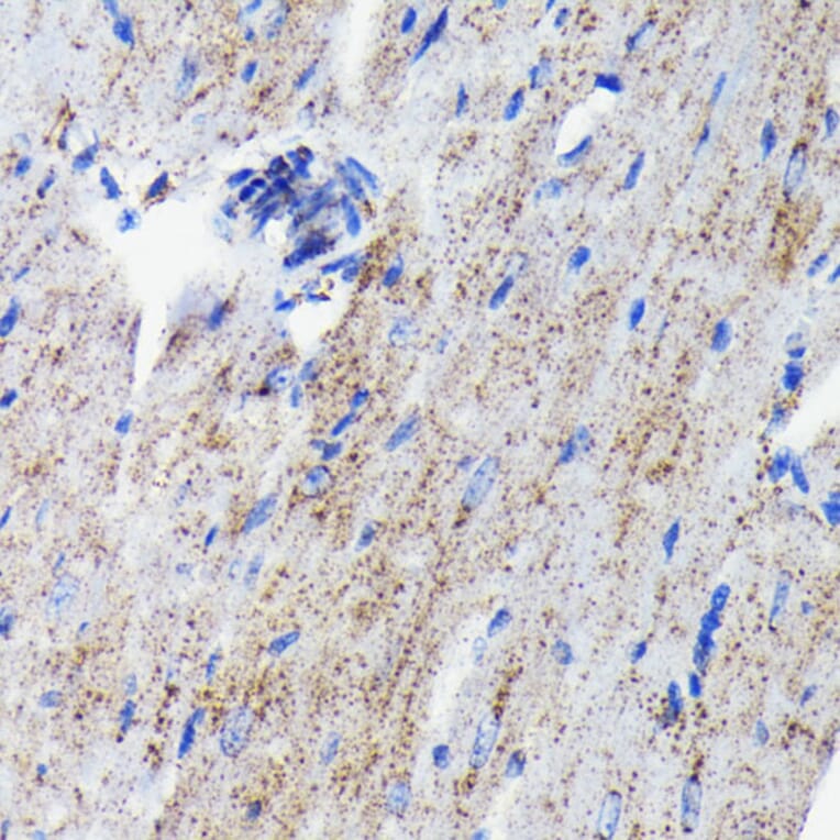 Immunohistochemistry - Anti-Cathepsin D Antibody [ARC0160] (A306359) - Antibodies.com