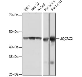 Western Blot - Anti-UQCRC2 Antibody [ARC0982] (A306361) - Antibodies.com