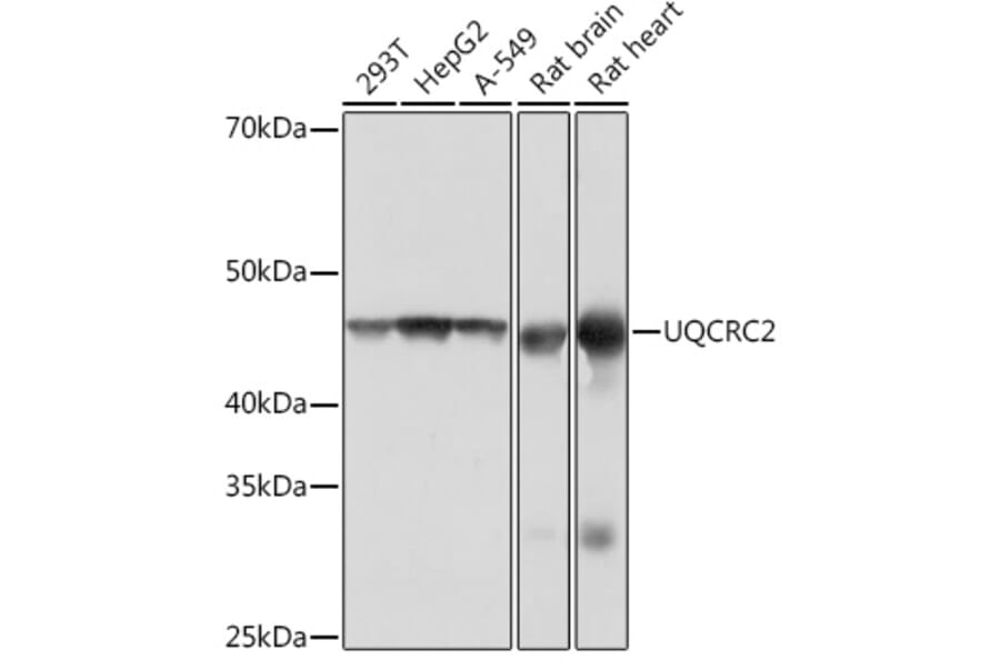 Western Blot - Anti-UQCRC2 Antibody [ARC0982] (A306361) - Antibodies.com