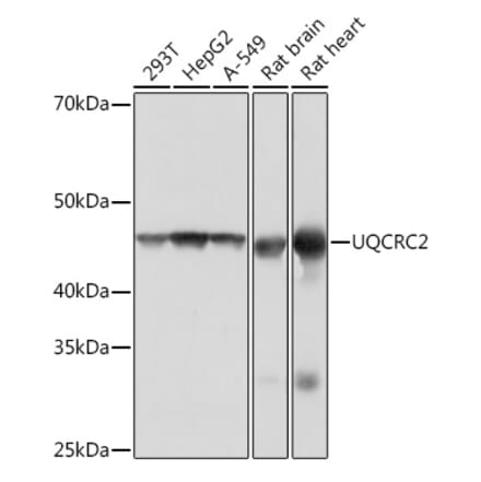 Western Blot - Anti-UQCRC2 Antibody [ARC0982] (A306361) - Antibodies.com
