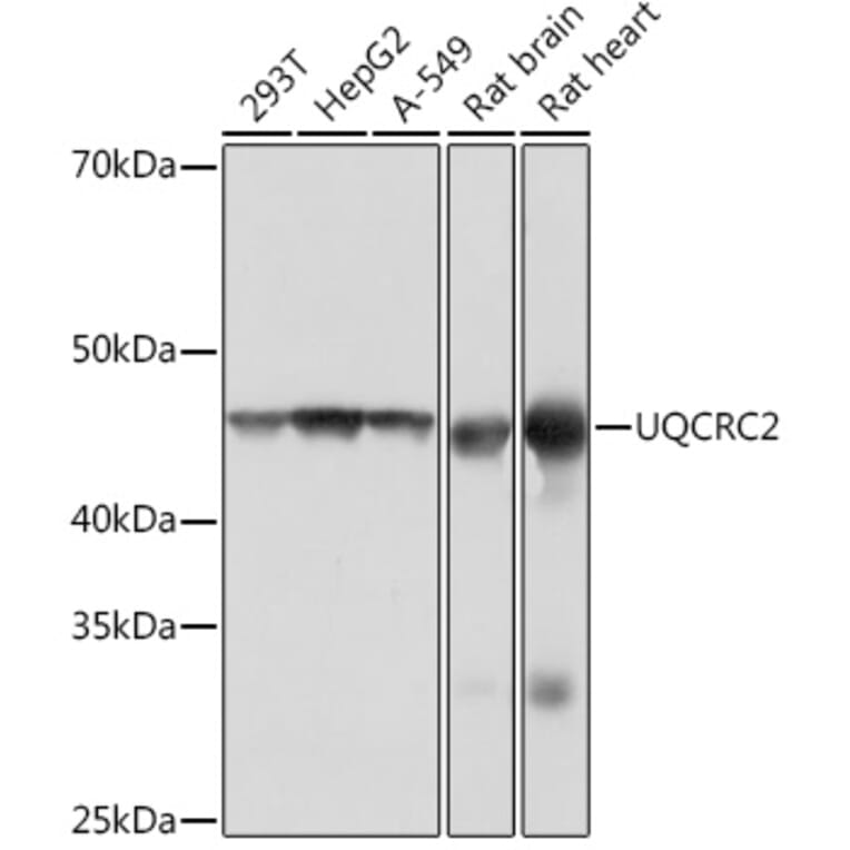 Western Blot - Anti-UQCRC2 Antibody [ARC0982] (A306361) - Antibodies.com