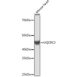 Western Blot - Anti-UQCRC2 Antibody [ARC0982] (A306361) - Antibodies.com