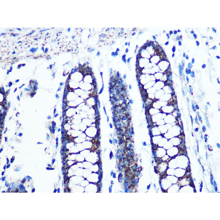 Immunohistochemistry - Anti-UQCRC2 Antibody [ARC0982] (A306361) - Antibodies.com