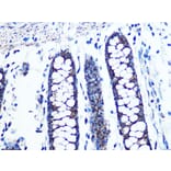 Immunohistochemistry - Anti-UQCRC2 Antibody [ARC0982] (A306361) - Antibodies.com