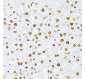 Immunohistochemistry - Anti-Histone H2A (phospho Ser129) Antibody (A306364) - Antibodies.com
