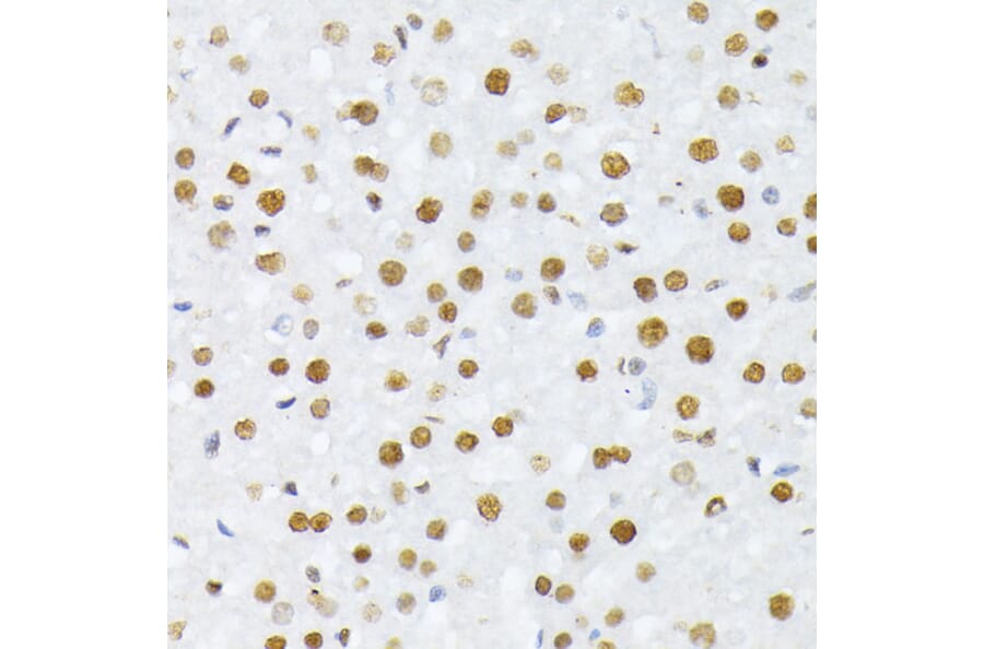 Immunohistochemistry - Anti-Histone H2A (phospho Ser129) Antibody (A306364) - Antibodies.com