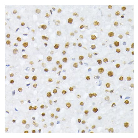 Immunohistochemistry - Anti-Histone H2A (phospho Ser129) Antibody (A306364) - Antibodies.com