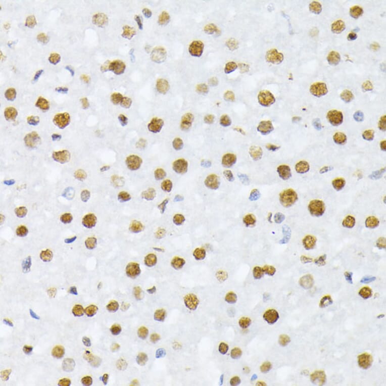 Immunohistochemistry - Anti-Histone H2A (phospho Ser129) Antibody (A306364) - Antibodies.com