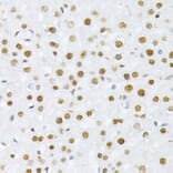 Immunohistochemistry - Anti-Histone H2A (phospho Ser129) Antibody (A306364) - Antibodies.com