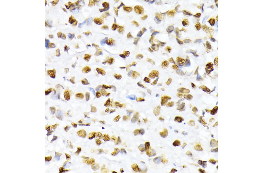 Immunohistochemistry - Anti-Histone H2A (phospho Ser129) Antibody (A306364) - Antibodies.com