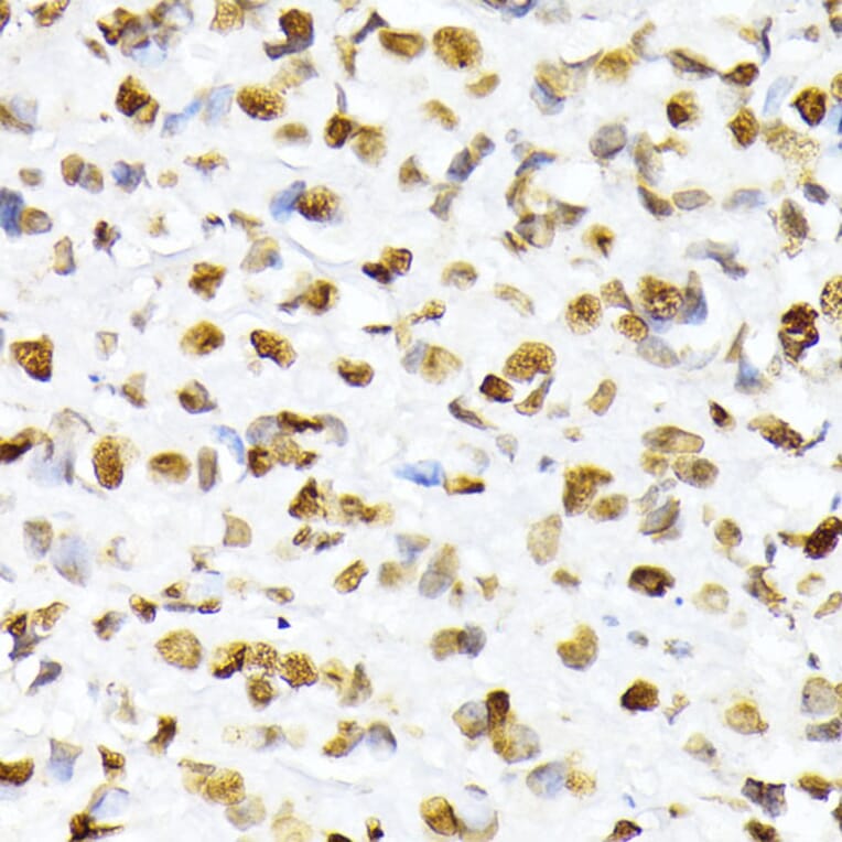 Immunohistochemistry - Anti-Histone H2A (phospho Ser129) Antibody (A306364) - Antibodies.com