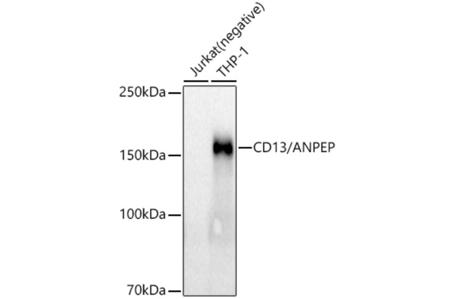 Western Blot - Anti-CD13 Antibody [ARC53706] (A306365) - Antibodies.com