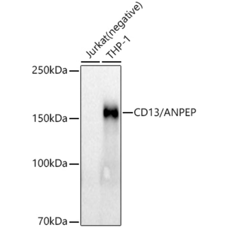 Western Blot - Anti-CD13 Antibody [ARC53706] (A306365) - Antibodies.com