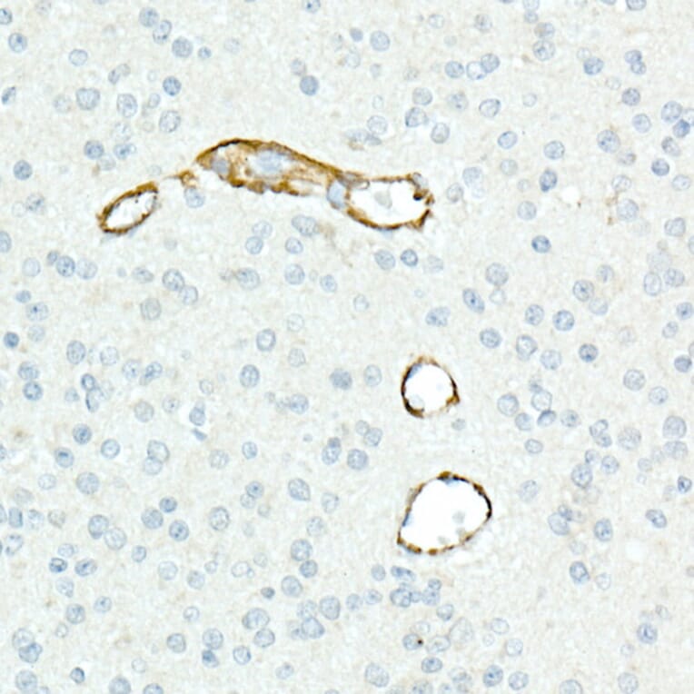 Immunohistochemistry - Anti-CD13 Antibody [ARC53706] (A306365) - Antibodies.com