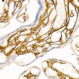 Immunohistochemistry - Anti-CD13 Antibody [ARC53706] (A306365) - Antibodies.com