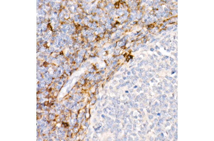 Immunohistochemistry - Anti-CD13 Antibody [ARC53706] (A306365) - Antibodies.com