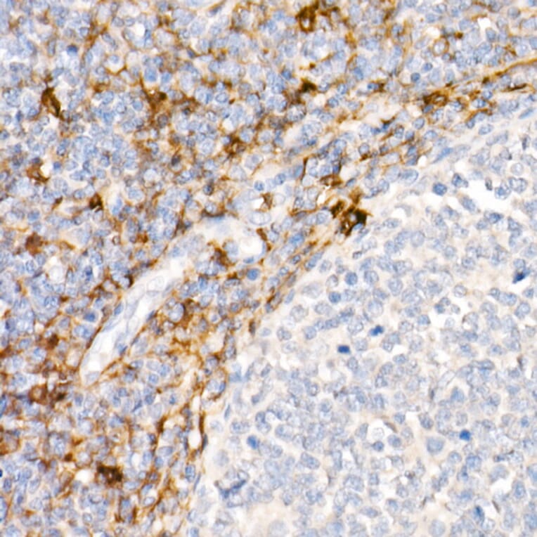 Immunohistochemistry - Anti-CD13 Antibody [ARC53706] (A306365) - Antibodies.com