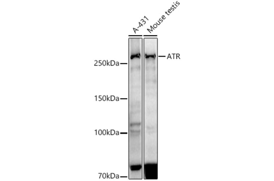 Western Blot - Anti-ATR Antibody [ARC51749] (A306366) - Antibodies.com