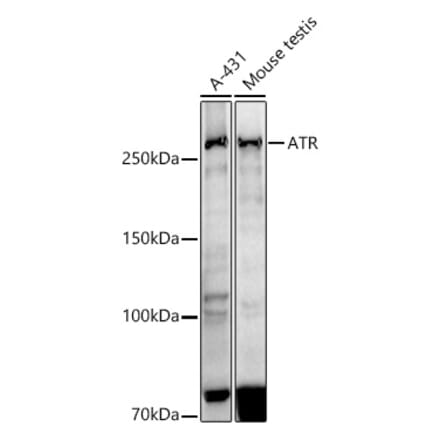 Western Blot - Anti-ATR Antibody [ARC51749] (A306366) - Antibodies.com
