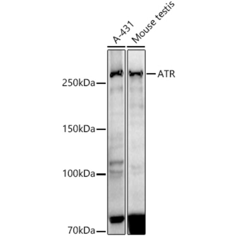 Western Blot - Anti-ATR Antibody [ARC51749] (A306366) - Antibodies.com