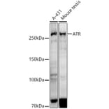 Western Blot - Anti-ATR Antibody [ARC51749] (A306366) - Antibodies.com