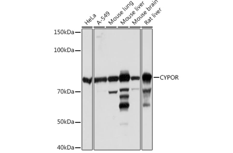 Western Blot - Anti-Cytochrome P450 Reductase Antibody [ARC1981] (A306367) - Antibodies.com