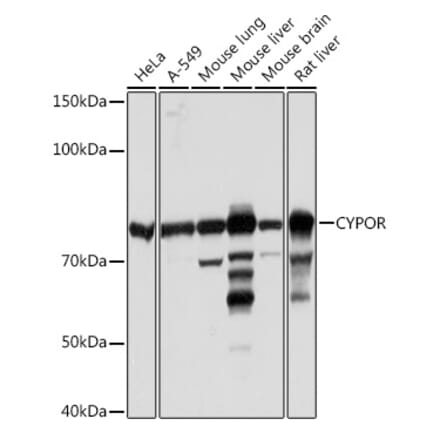 Western Blot - Anti-Cytochrome P450 Reductase Antibody [ARC1981] (A306367) - Antibodies.com