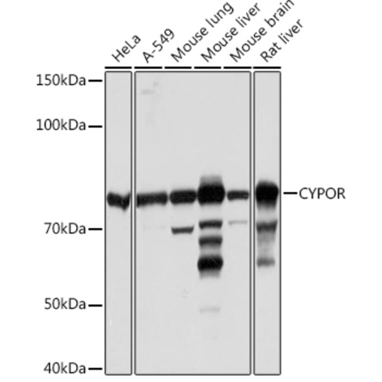 Western Blot - Anti-Cytochrome P450 Reductase Antibody [ARC1981] (A306367) - Antibodies.com