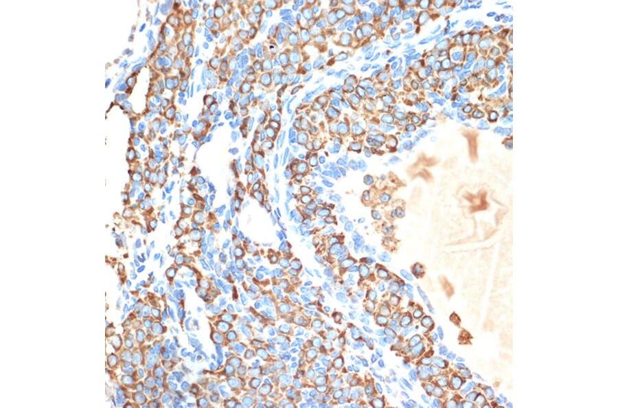Immunohistochemistry - Anti-Cytochrome P450 Reductase Antibody [ARC1981] (A306367) - Antibodies.com