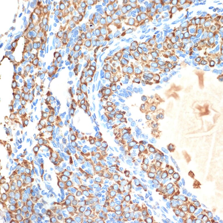 Immunohistochemistry - Anti-Cytochrome P450 Reductase Antibody [ARC1981] (A306367) - Antibodies.com