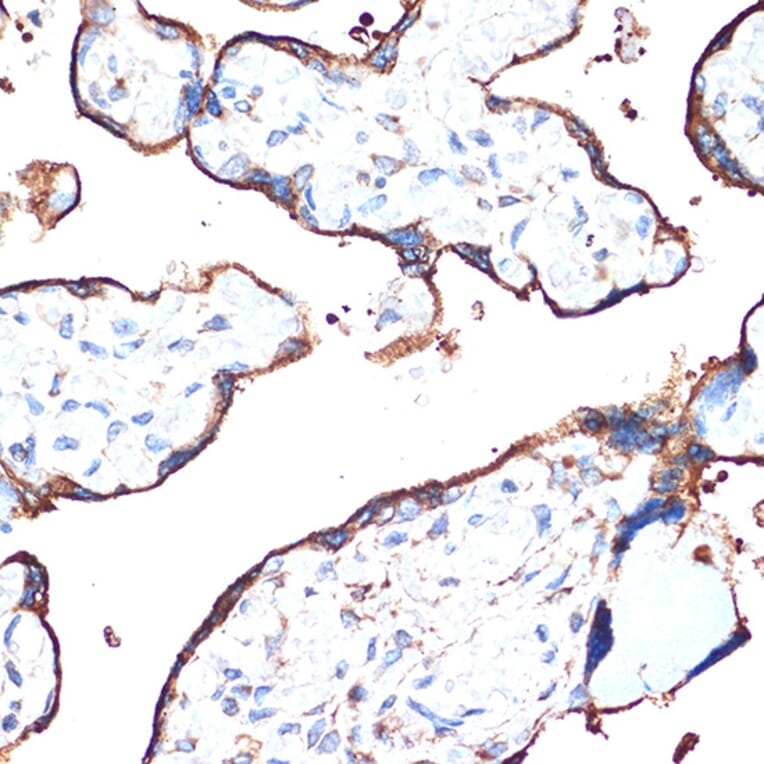 Immunohistochemistry - Anti-Cytochrome P450 Reductase Antibody [ARC1981] (A306367) - Antibodies.com