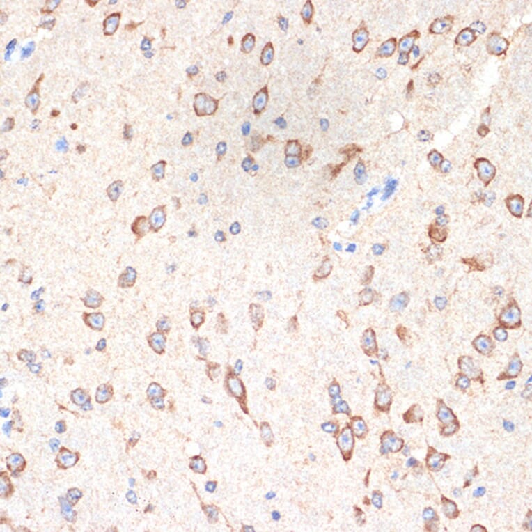 Immunohistochemistry - Anti-Cytochrome P450 Reductase Antibody [ARC1981] (A306367) - Antibodies.com