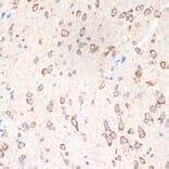 Immunohistochemistry - Anti-Cytochrome P450 Reductase Antibody [ARC1981] (A306367) - Antibodies.com