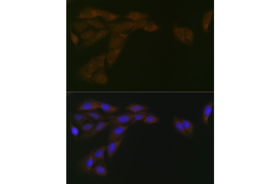 Immunofluorescence - Anti-Cytochrome P450 Reductase Antibody [ARC1981] (A306367) - Antibodies.com