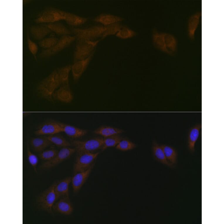 Immunofluorescence - Anti-Cytochrome P450 Reductase Antibody [ARC1981] (A306367) - Antibodies.com