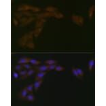 Immunofluorescence - Anti-Cytochrome P450 Reductase Antibody [ARC1981] (A306367) - Antibodies.com