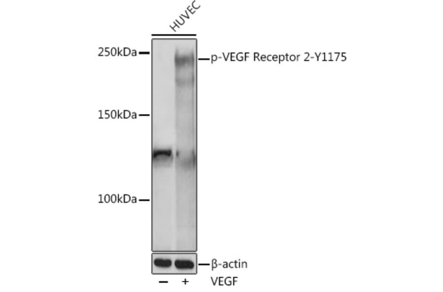 Western Blot - Anti-VEGF Receptor 2 (phospho Tyr1175) Antibody (A306370) - Antibodies.com