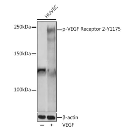 Western Blot - Anti-VEGF Receptor 2 (phospho Tyr1175) Antibody (A306370) - Antibodies.com