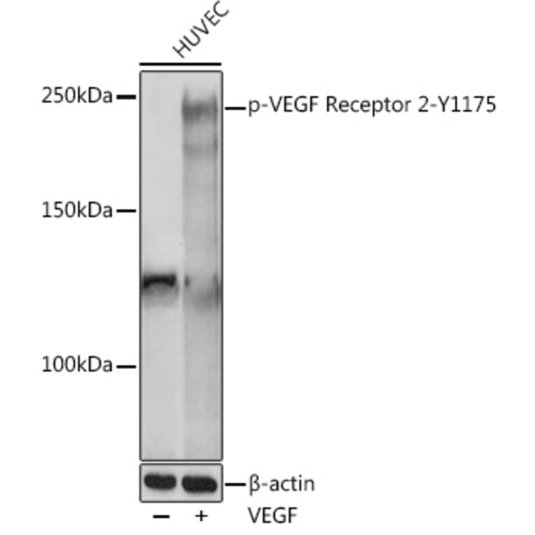 Western Blot - Anti-VEGF Receptor 2 (phospho Tyr1175) Antibody (A306370) - Antibodies.com