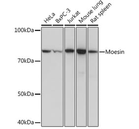 Western Blot - Anti-Moesin Antibody [ARC1258] (A306371) - Antibodies.com