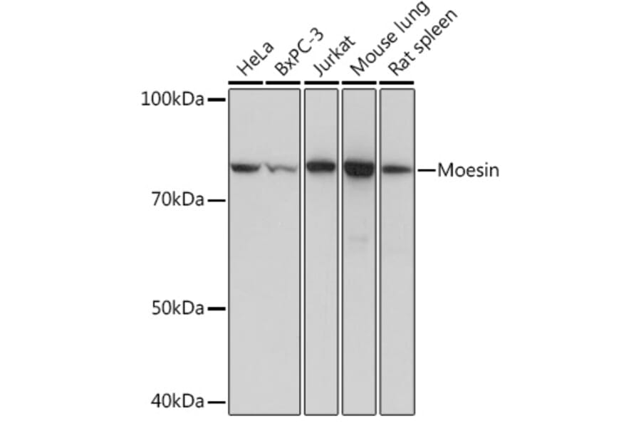 Western Blot - Anti-Moesin Antibody [ARC1258] (A306371) - Antibodies.com