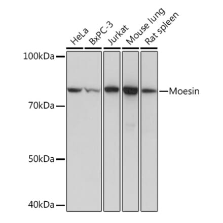 Western Blot - Anti-Moesin Antibody [ARC1258] (A306371) - Antibodies.com