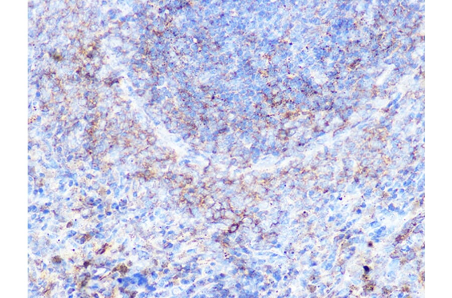 Immunohistochemistry - Anti-Moesin Antibody [ARC1258] (A306371) - Antibodies.com