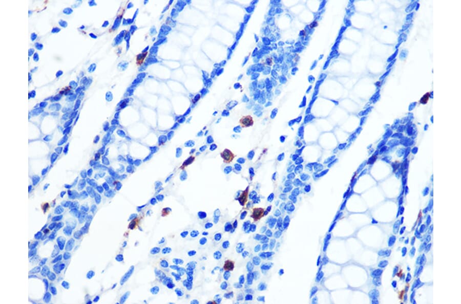 Immunohistochemistry - Anti-Moesin Antibody [ARC1258] (A306371) - Antibodies.com