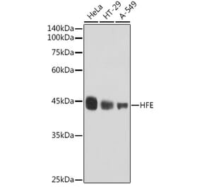 Western Blot - Anti-HFE Antibody [ARC2554] (A306374) - Antibodies.com