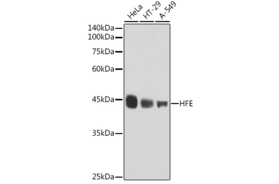 Western Blot - Anti-HFE Antibody [ARC2554] (A306374) - Antibodies.com